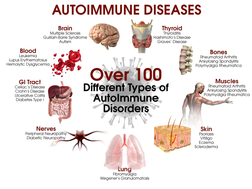 Autoimmune Disease infographic