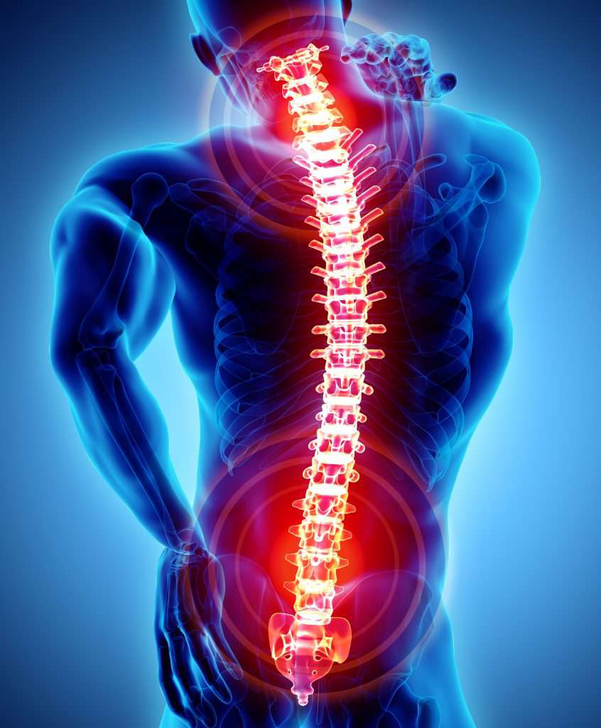 Back Spasms & Stem Cells: A different approach to relief