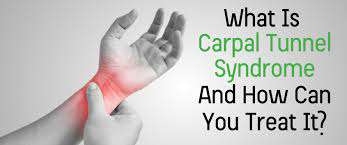 Carpal Tunnel Syndrome