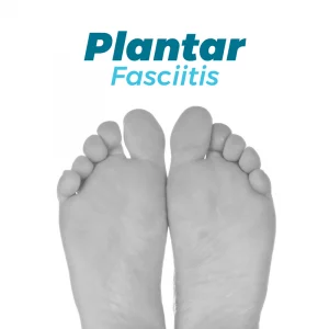 Plantar fasciitis