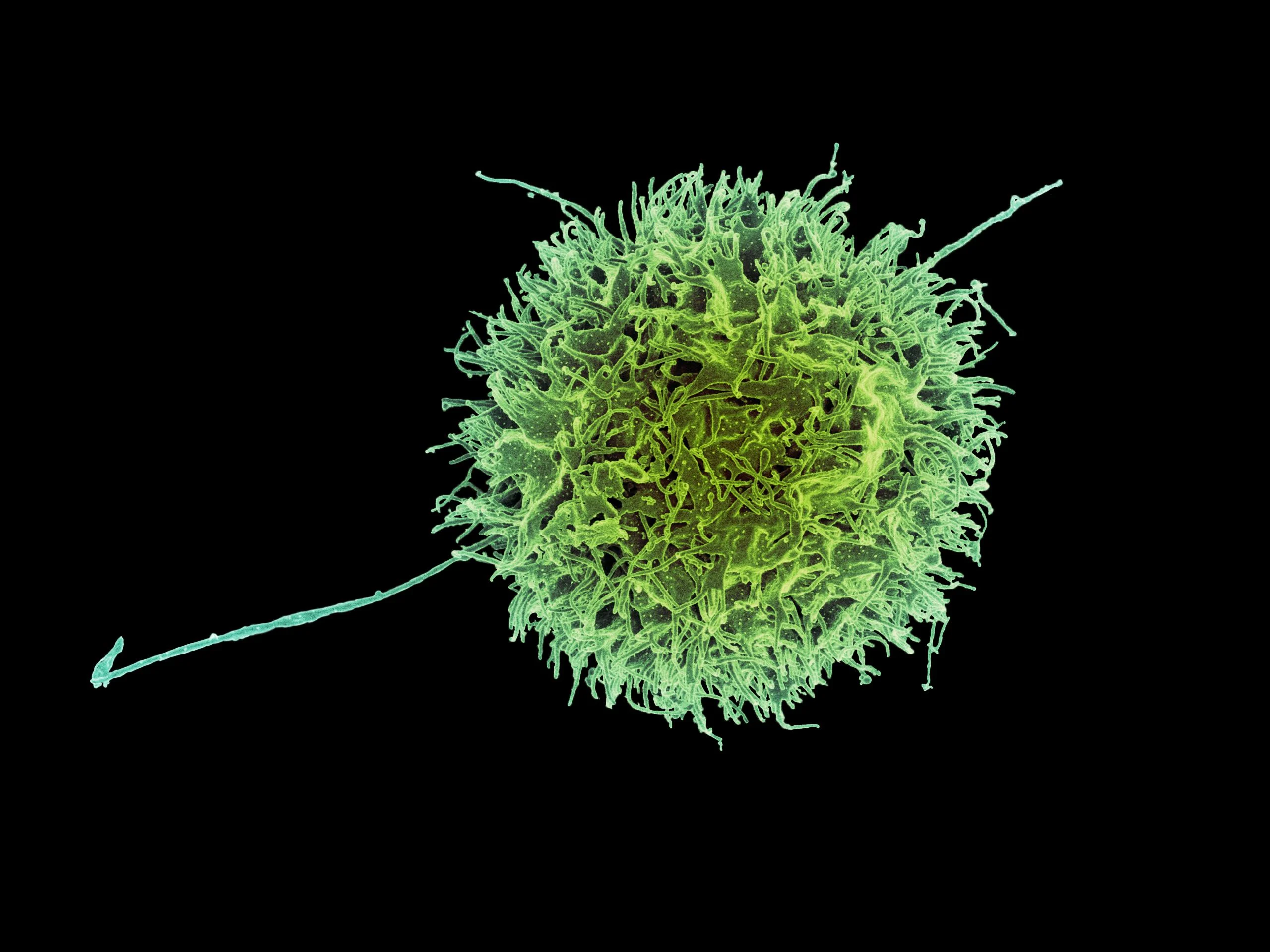 What is the function of natural killer NK cells? Autoimmune Disorders