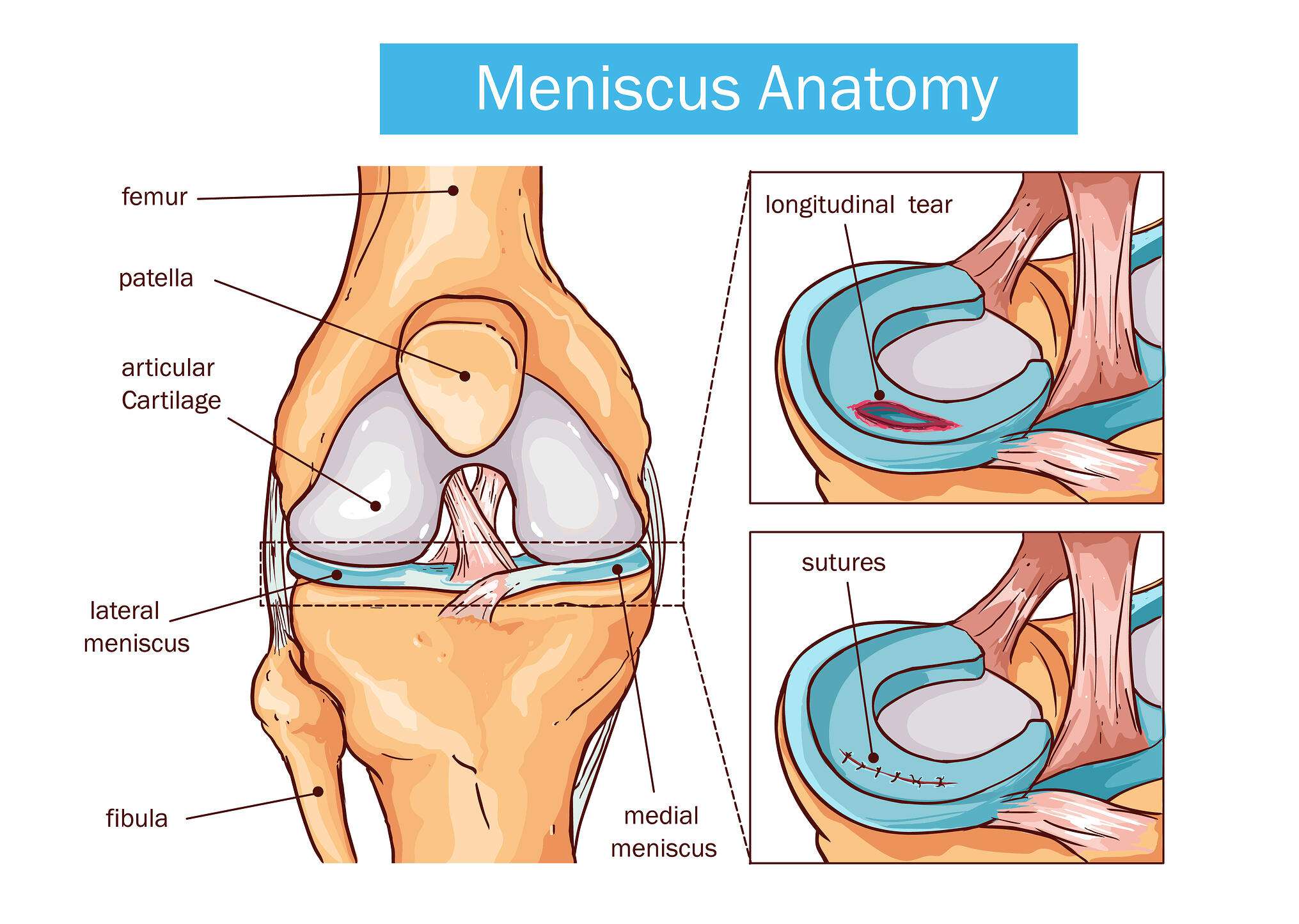 Meniscus Anatomy