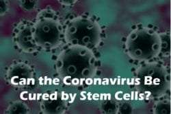 coronavirus and stem cell therapy