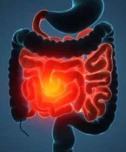 crohns treatment image