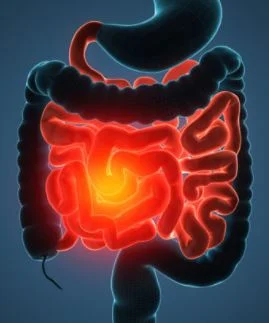 crohns treatment image