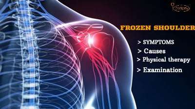 What is the Best Thing to do for Frozen Shoulder? Stem Cell Treatment