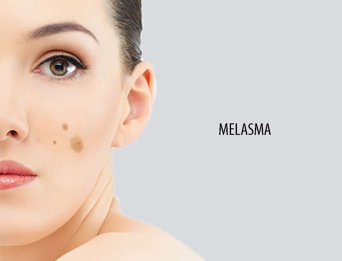 glutathione soap image Skin White Glutathione +Vitamin C Soap – MamaTega