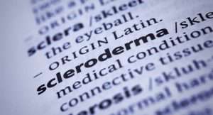 scleroderma