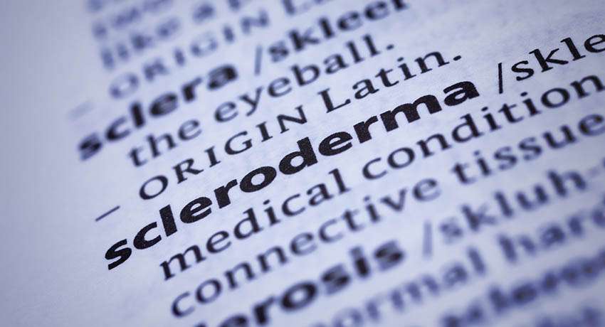 scleroderma