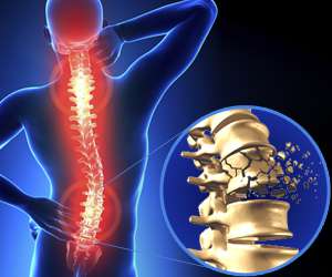 Can You Fully Recover from a Spinal Cord Injury? Stem Cell Treatment