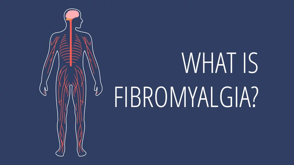 fibromyalgia