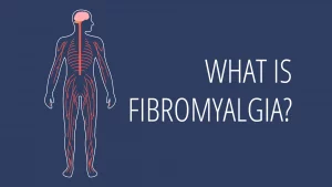 fibromyalgia