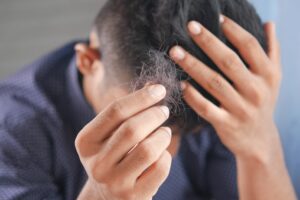 Hair loss affects nearly half of all people by the age of 50 and can have a negative impact on self-esteem and overall well-being