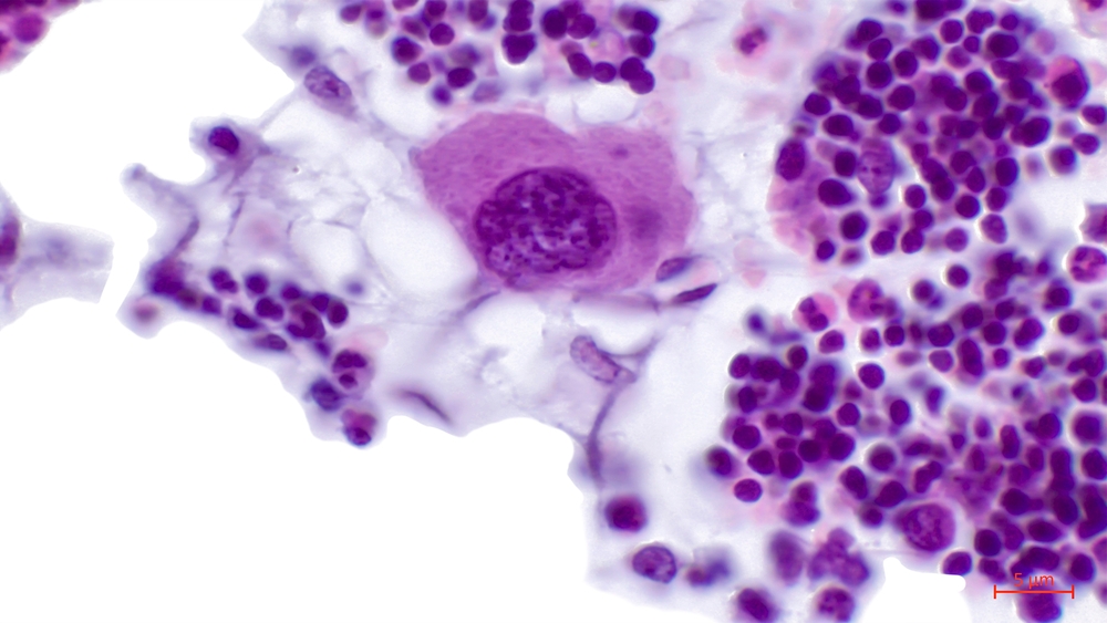 Bone marrow cells under a microscope